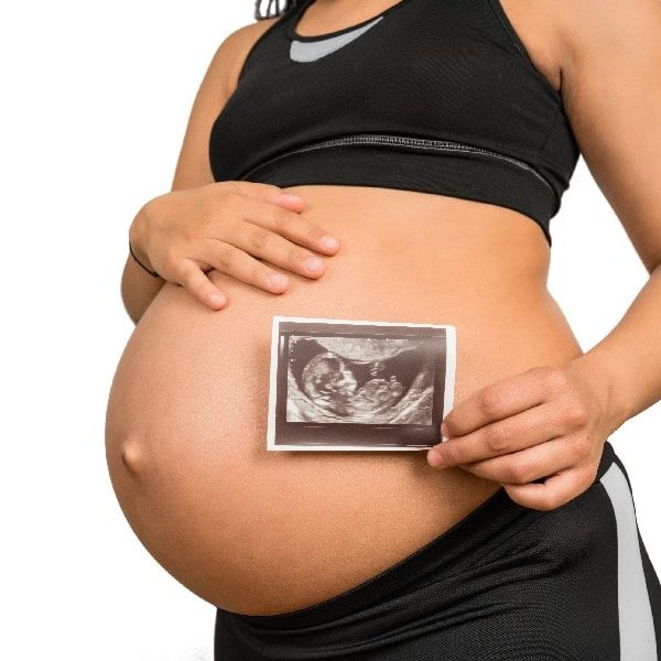 Ecografia Embarazo Quito Dr Ricardo Miranda-min